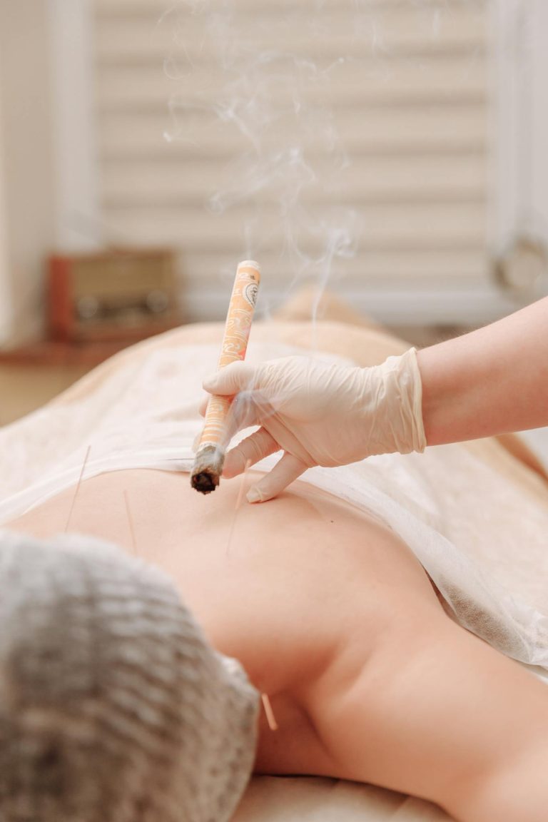 A moxibustion therapy session with acupuncture, showcasing traditional Chinese medicine techniques.